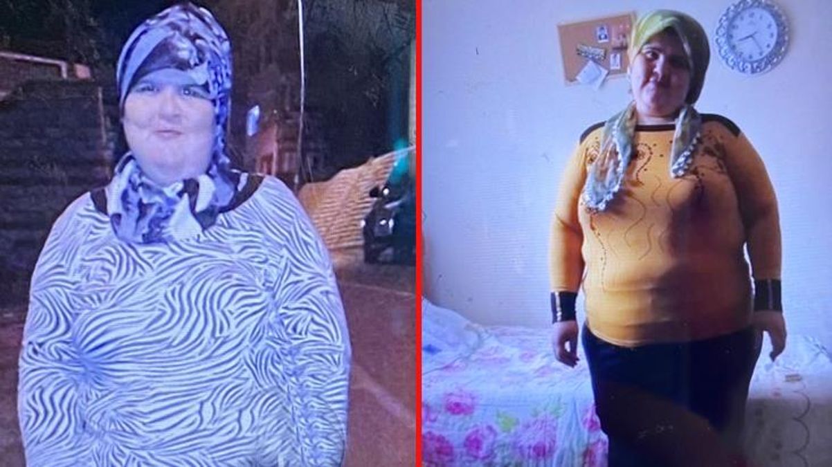 Zayıflamak için internetten aldığı ilaç hayatını zindana çevirdi! 350 kiloyu aşınca eşi başka bir kadınla kaçtı