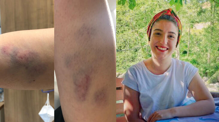  Corona hastası genç doktora kabusu yaşattı! İşte doktorun yaşadıkları...