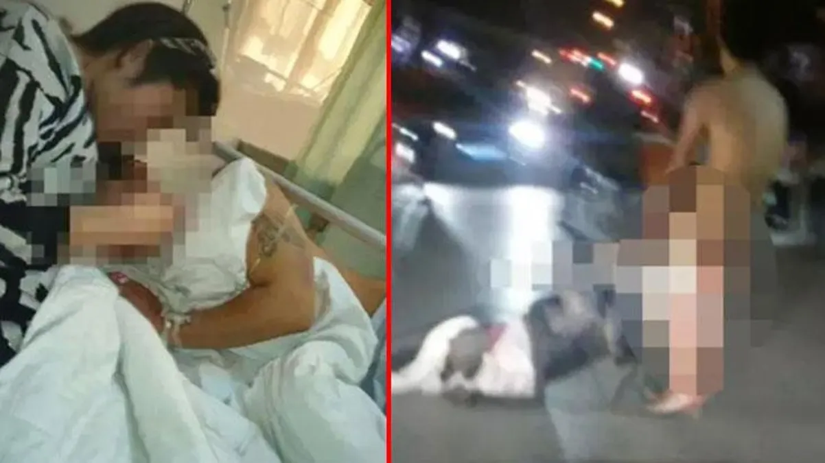 Aldatan kocasının cinsel organını kesti, doktorlar dikince bu kez koparıp camdan attı