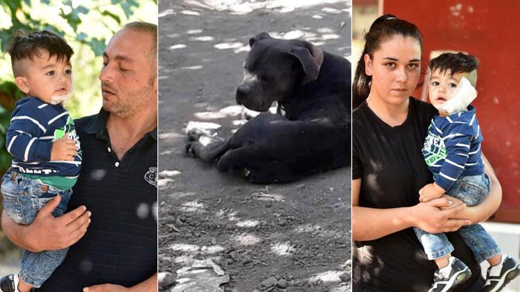 Antalya'da pitbull, 11 aylık bebeğin yanağını ve kulağını kopardı