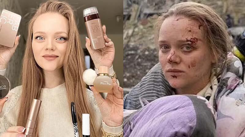 Bombalanan hastaneden kurtulan hamile kadına 'yalancı' dedi! Rus elçilik anında sildi