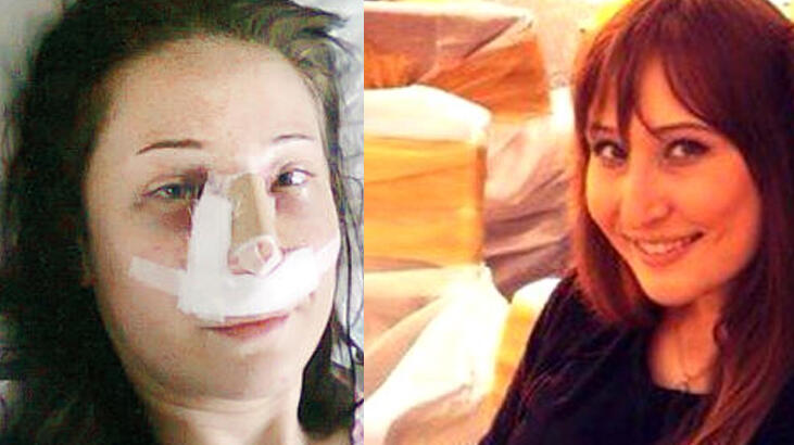 Burun ameliyatı oldu, iki bacağı da kesildi! 6 hakim değişti ama...