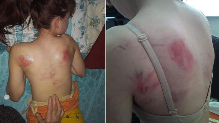 Cani baba, kızını ne hale getirdi