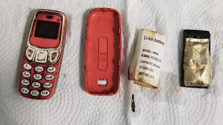 Doktorlar inanamadı! Midesinden üç parça halinde çıkardılar