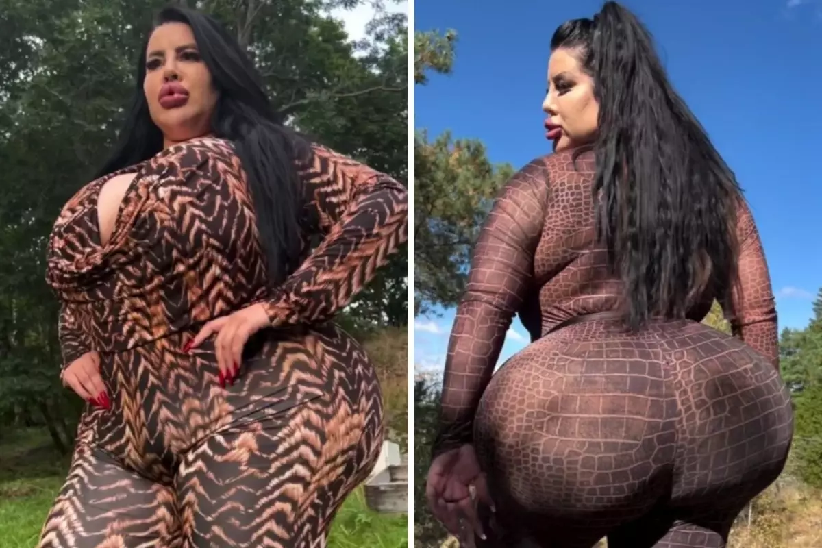 Dünyanın en büyük kalçasına sahip olmak istiyordu! Ortaya çıkan sonuç korkunç