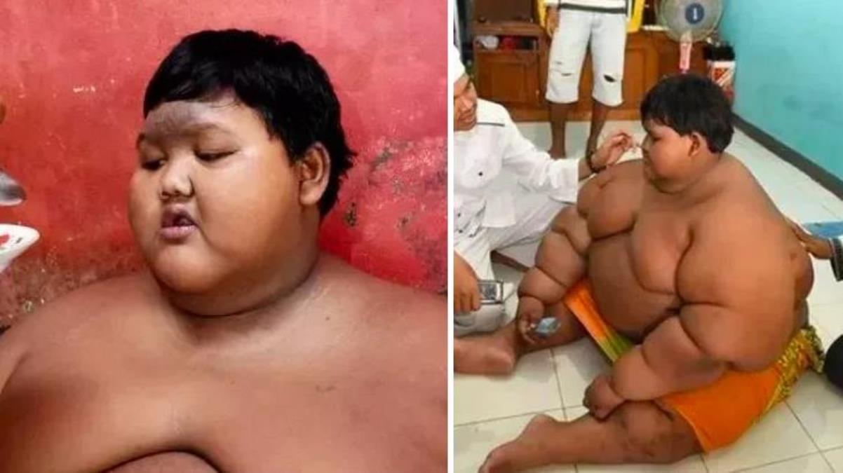 Dünyanın en şişman çocuğuydu, azmedip zayıfladı! Son halini görenler tanıyamıyor