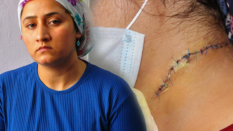 Eşi tarafından boğazı kesildi! Korkuyorum, sokağa bile çıkamıyorum