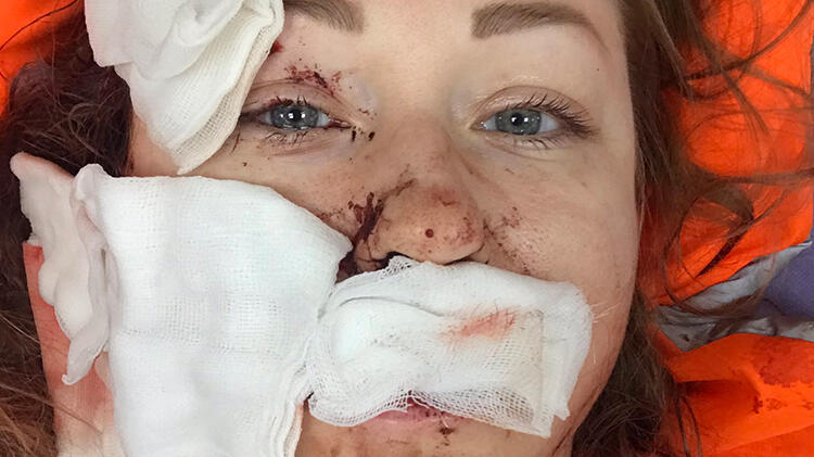 Falçata vahşetini anlattı! Beni öldürmek istedi