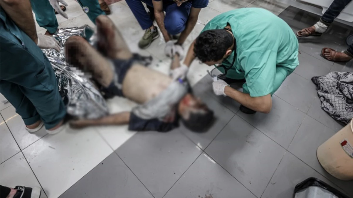 Gazze Sağlık Bakanlığı: İsrail, ciddi yanıklara neden olan 'alışılmadık silahlar' kullanıyor