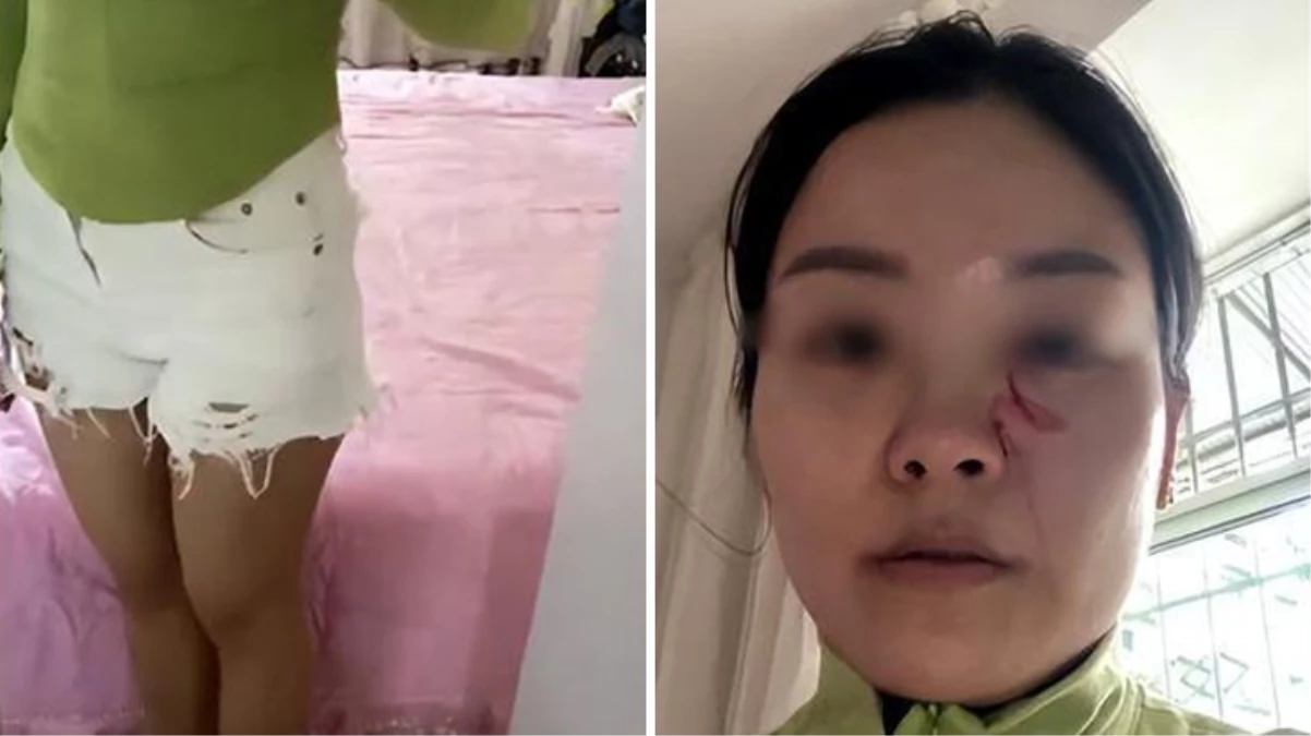 Gelininin şortunu kısa bulan kayınpeder öfkeden deliye döndü