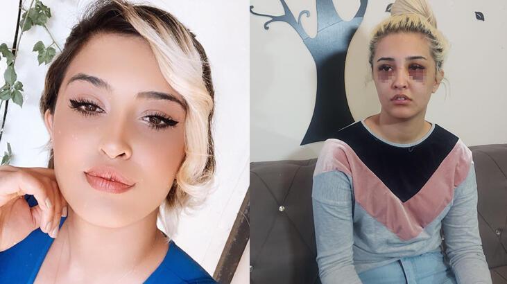 Genç kadın yaşadığı dehşeti anlattı! '2 saat uyuyalım gideceğim' demiş