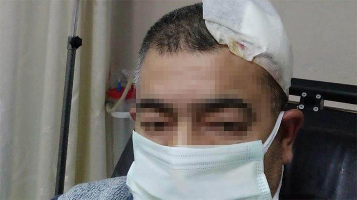 Görevini aksattığı için uyardı kafasına 10 dikiş atıldı