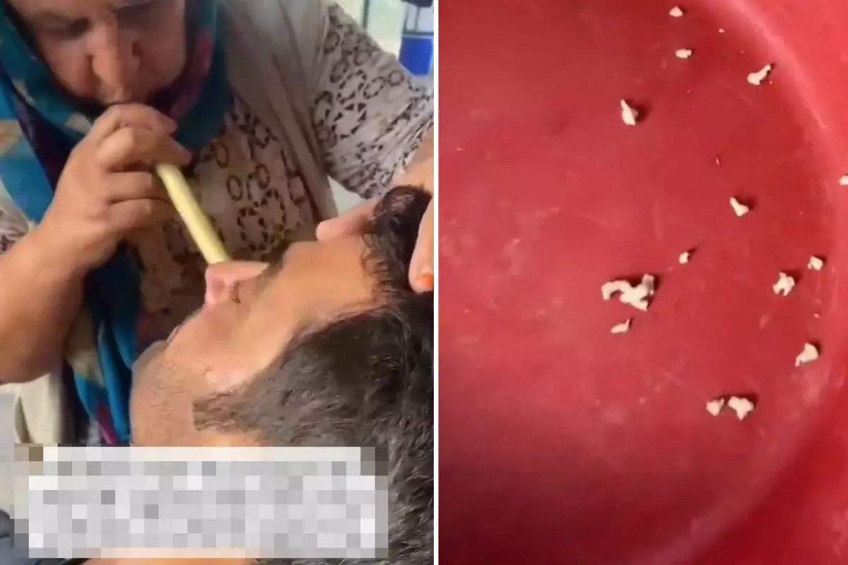 Hindistan değil Adana! Bu saçmalığa inanıp tedavi için gidenler var