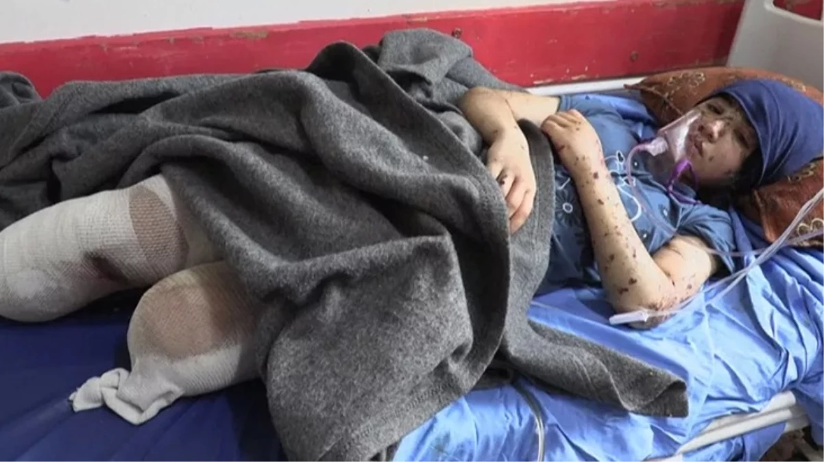 İki bacağını kaybeden Gazzeli kızın sözleri yürek dağladı