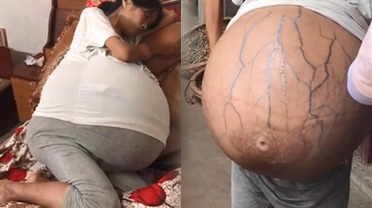 İnanılmaz! Doktora da gitti ama gizemi çözülemedi