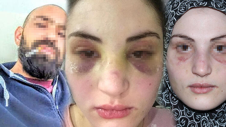 Kaçarak evlendiği kocası, hayatını zindana çevirdi!