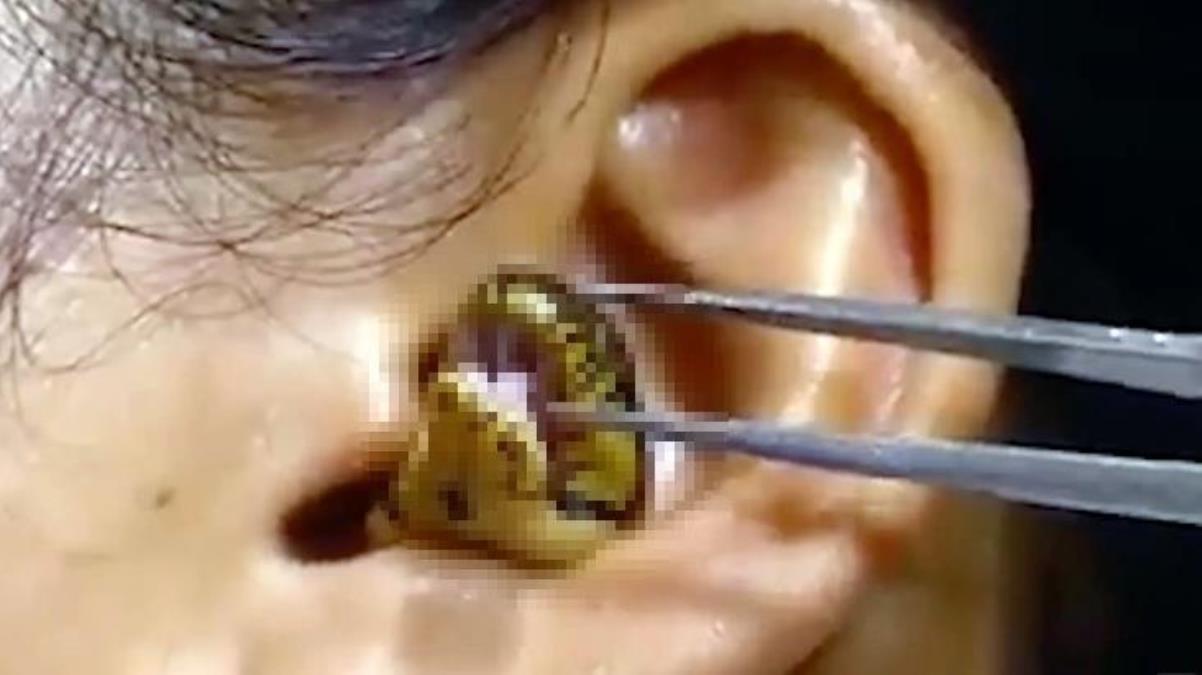 Kadının kulağına yılan kaçtı! Videoyu izleyip kurgu diyen de var gerçek diyen de