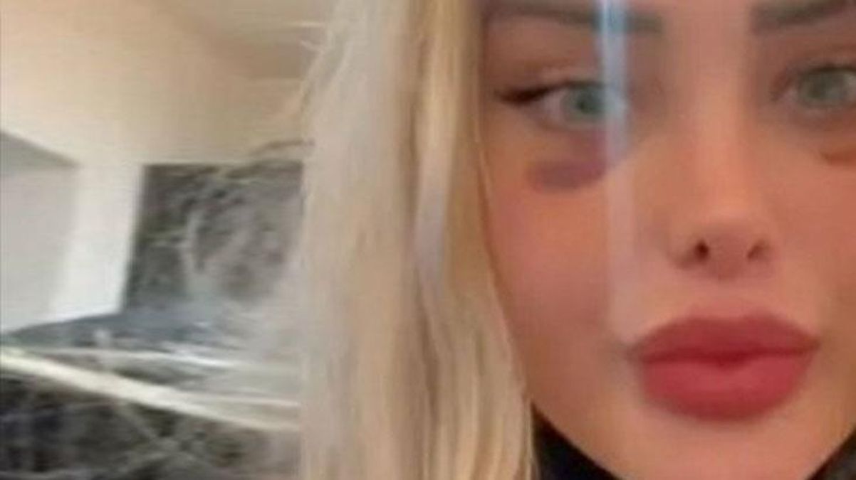 Kan basıncı uçaktayken aniden fırlayan fenomenin adeta kafası patladı