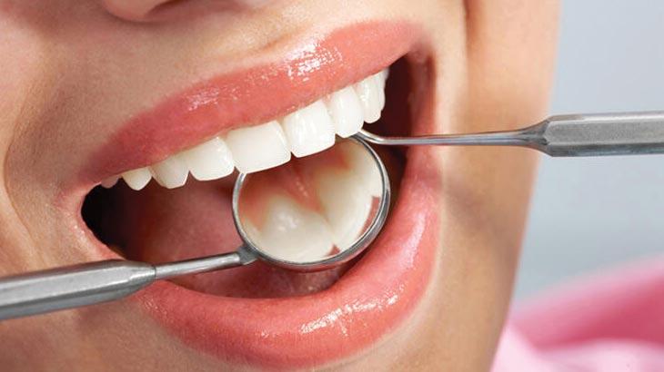 Kanal, protez, dolgu mümkünse tek seansta