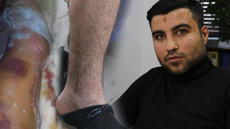 Kazada ayağından da işinden de oldu! 45 bin lira tazminat alabildi