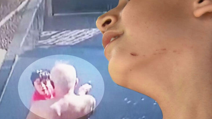 Komşu dehşeti! Küçük çocuğun yüzüne anahtarla vurdu