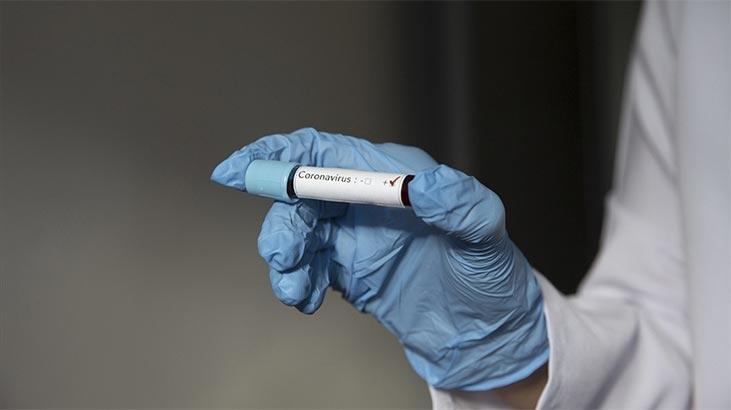 Koronavirüs ilacı geliyor mu? Umut veren gelişme