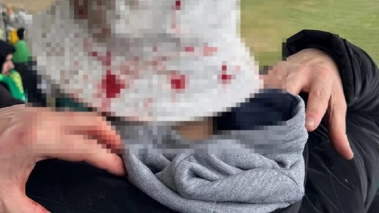 “Muş’ta Skandal! Bursaspor Taraftarına Taşlı Saldırı”