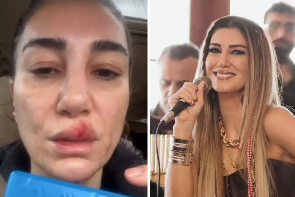Nadide Sultan temizlik sırasında kaza geçirdi! Kanlar içinde hastaneye gitti