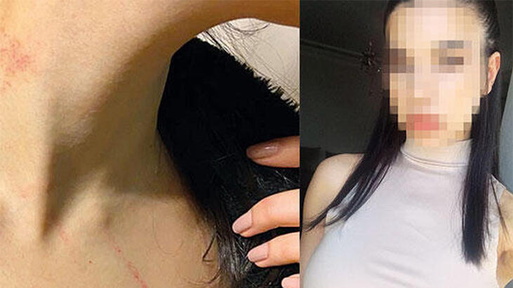 'Odaya sürükleyip kapıyı kapattı!' Kabusu böyle anlattı...