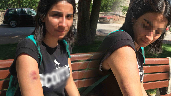 'Otobüse artık rahat binemiyorum. Böyle insanlar var'