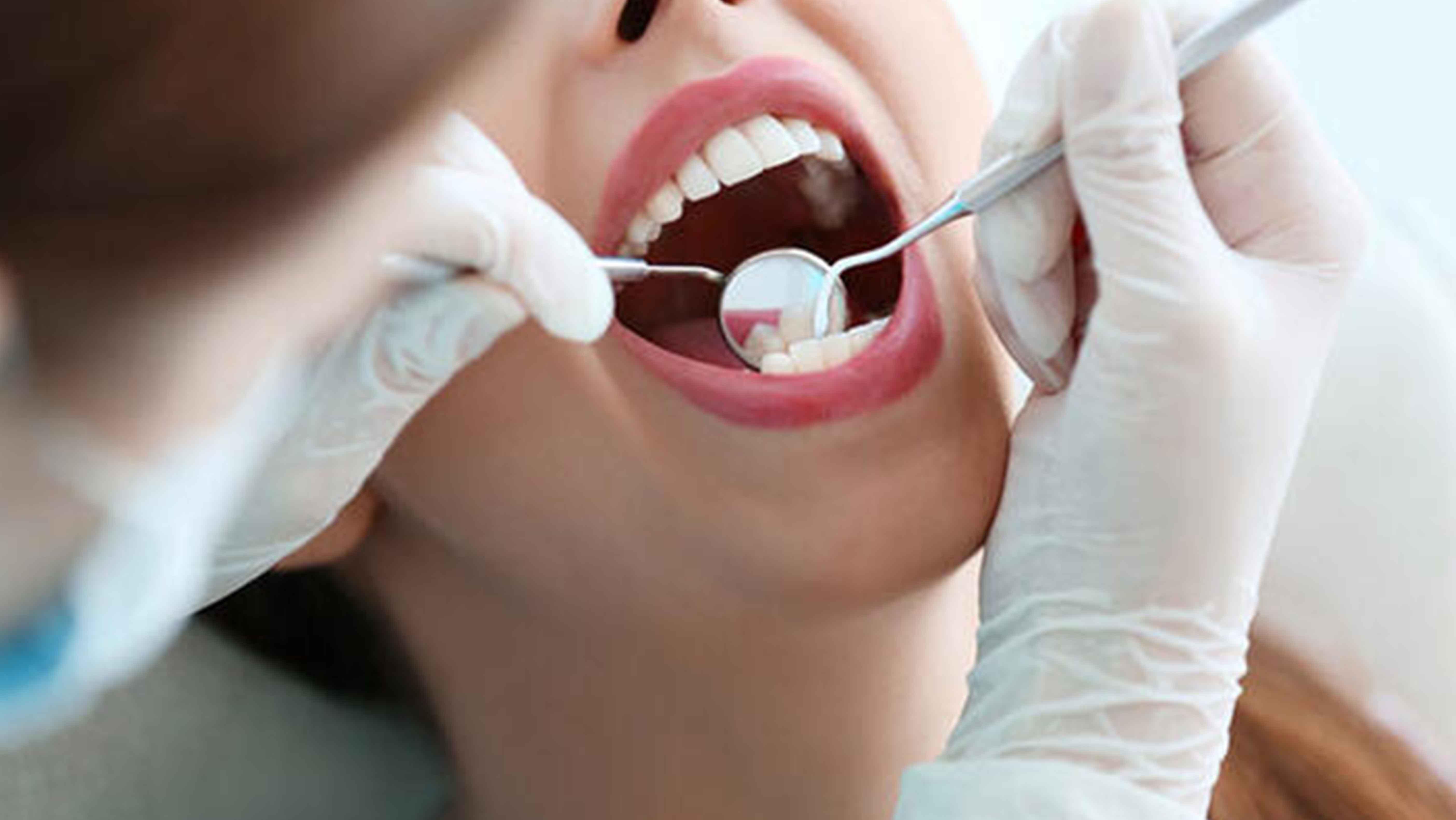 Pandemi nedeniyle diş tedavilerini ihmal edenler dikkat!