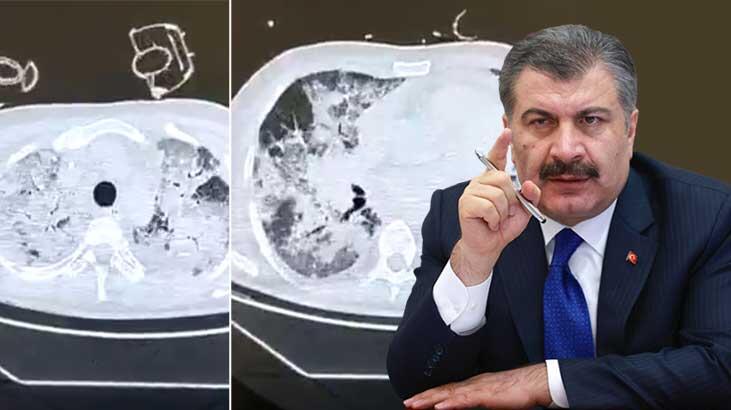 Sağlık Bakanı Fahrettin Koca'dan peş peşe paylaşımlar