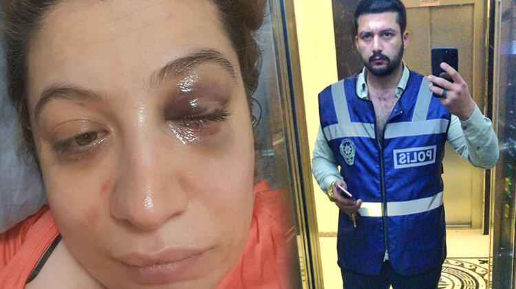 Şiddet gördüğü eski eşi serbest bırakılan Rüya: Yaşamak istiyorum