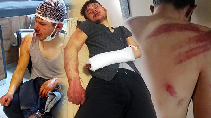 200 lira alacağı için 5 saat boyunca dövüştü! Tutuklandı