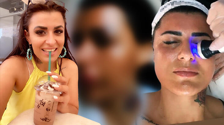 Bu karenin sonrası korkunç! 'Eksi fotoğraflarıma bakıp ağlıyorum'