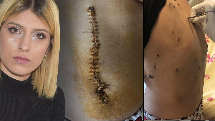 'Bu son yemeğin, güzel ye' dedi ve dehşeti yaşattı! 38 yerinden bıçakladı