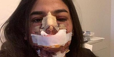 Avusturya'dan İstanbul'a gelen genç kadına estetik şoku!