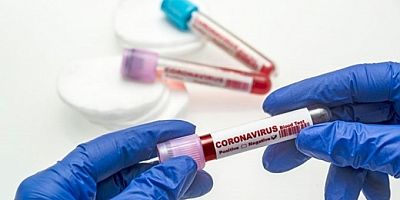 Bakan son durumu paylaştı! Türkiye'de virüsten 297 can kaybı daha