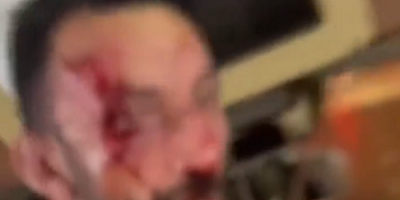 Bursa'da kız çocuğuna taciz iddiası! Linç edildi