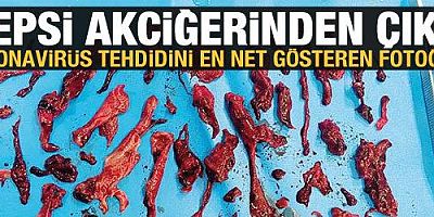Covid-19 tehdidini ortaya koyan fotoğraf!