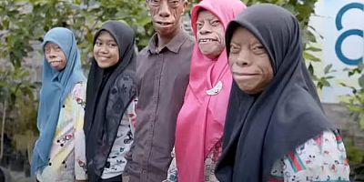 Dünya bu görüntüleri konuşuyor! 