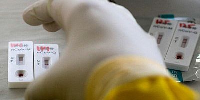 Dünya Sağlık Örgütü duyurdu! Virüs tedavisinde tek etkili ilaç