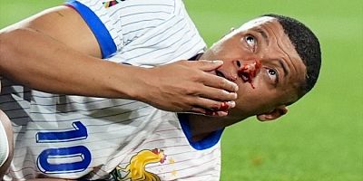 EURO 2024'te talihsiz an: Mbappe'nin burnu kırıldı