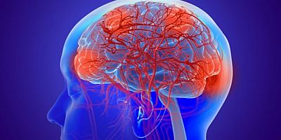 Gizemli beyin hastalığı: 5 kişi hayatını kaybetti