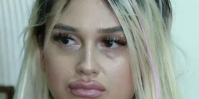 Göğüs dikleştirme ameliyatı kabusu oldu!