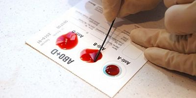 Kan grubu Kovıd-19'da etkili mi?