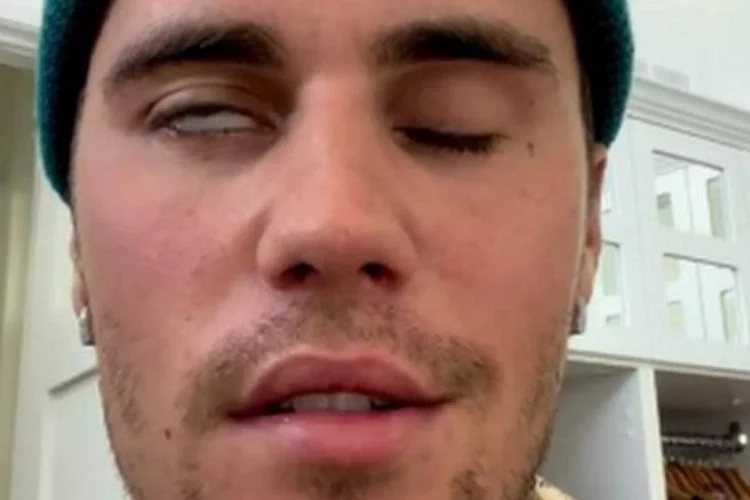 Kanadalı şarkıcı yüz felci geçirdi