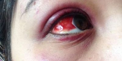 Kadına şiddet: Bunu yapan bir avukat