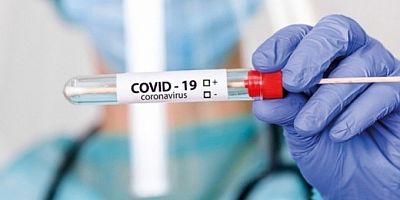 Korkutan açıklama! 'Salgının sona ermesi için uzun bir yol var'