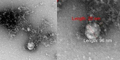 Korona virüsün mutasyonu ilk kez görüntülendi!